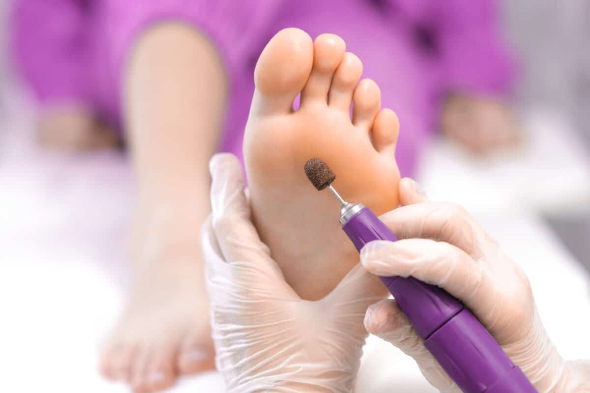 Comment retrouver sa beauté des pieds après l’été ?