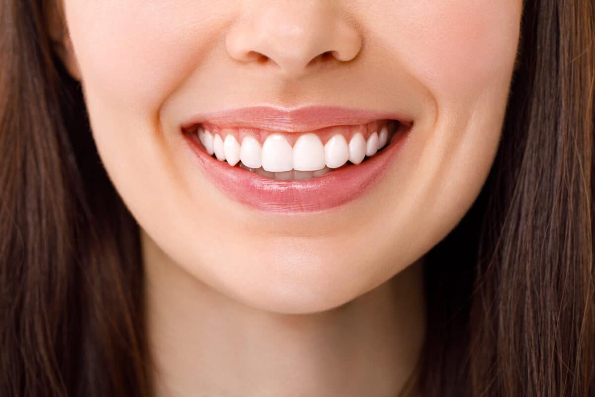 5 astuces pour de belles dents blanches